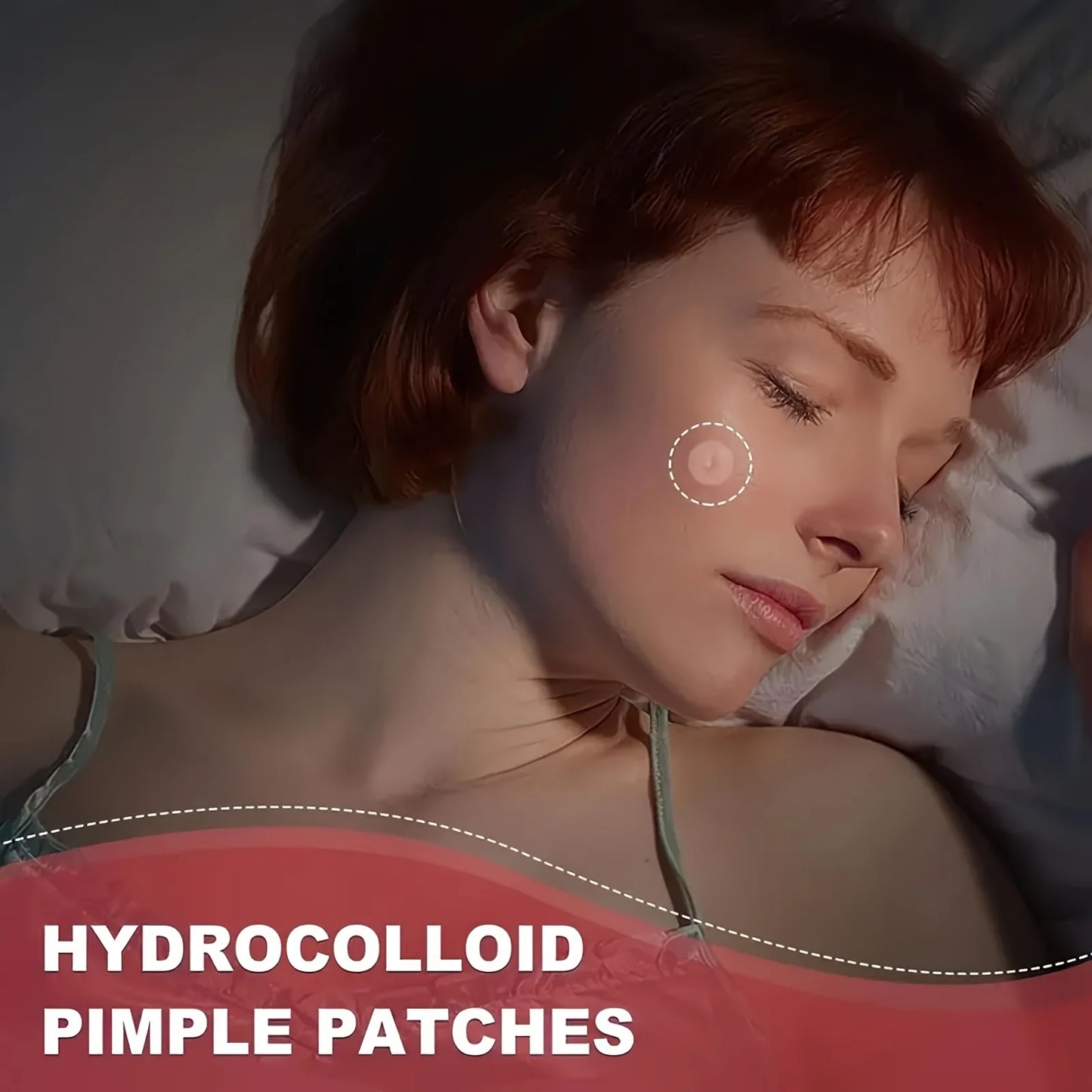 GlowClear Pimple Patches – Hydrocolloid Acne Patches (36 pcs)